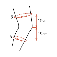 Knee Support- Genu Sensa